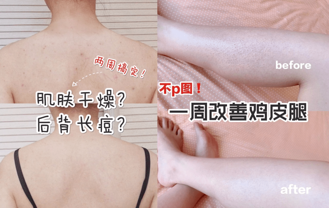 2ebf2a70f2864cbc99873ee908ffaf3a.png
