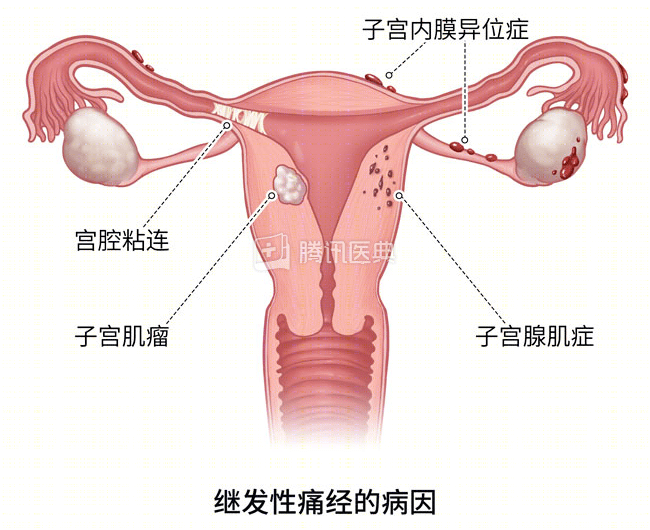 突然痛经很厉害怎么办