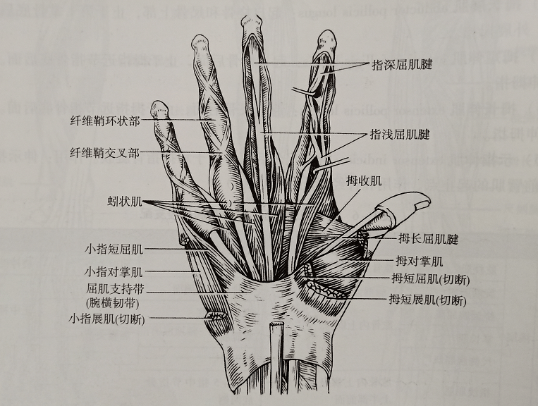 图3 手部肌肉解剖图chor相关实操演示1手内肌的促通:2