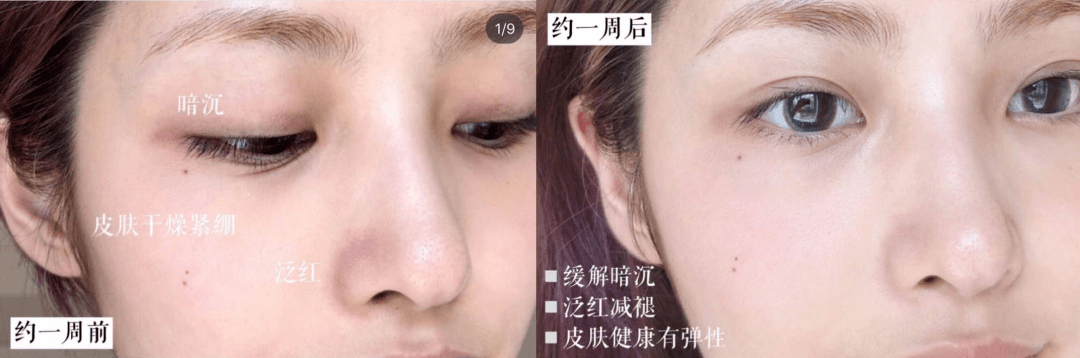 品牌专柜正品 | 雅诗兰黛骨折价限量抢，送眼霜、精华小样，买一送3