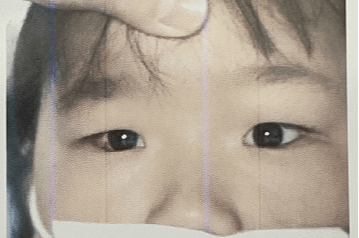 7岁双胞胎姐妹同患斜视急坏父母_任小军_孩子_检查