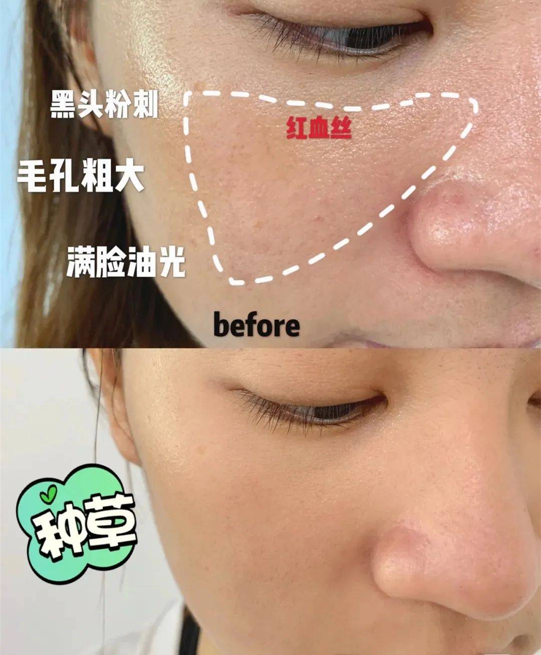 投资海蓝之谜正品5折价抢疯！补水、淡纹、修护，让你重回婴儿肌