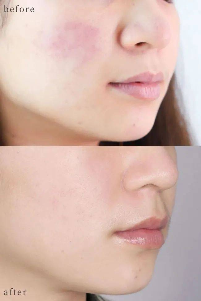 投资海蓝之谜正品5折价抢疯！补水、淡纹、修护，让你重回婴儿肌