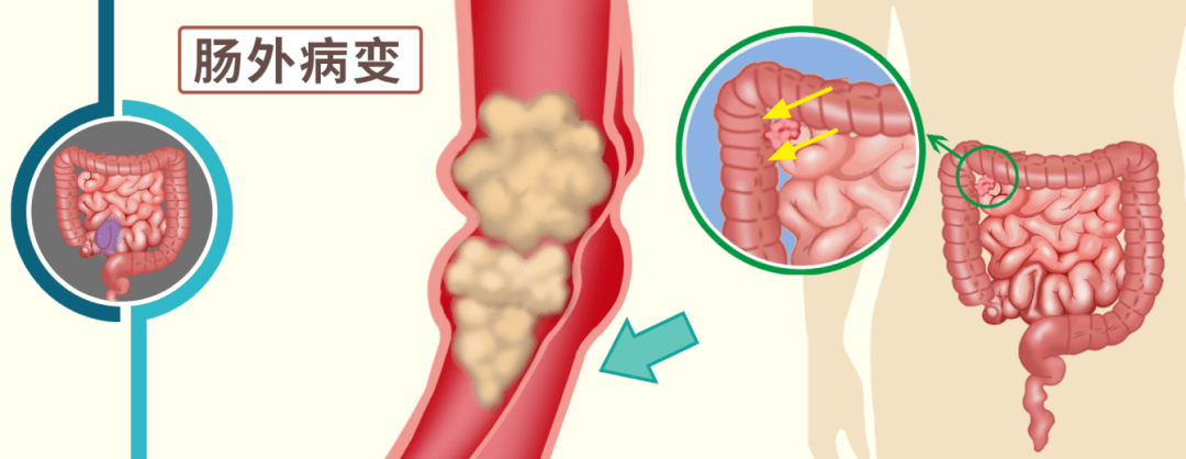 肠壁平滑肌图片