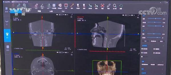 5G技术助力北京冬奥会闪耀智慧之光 打造“智慧观赛、智慧办赛、智慧参赛”的全新体验