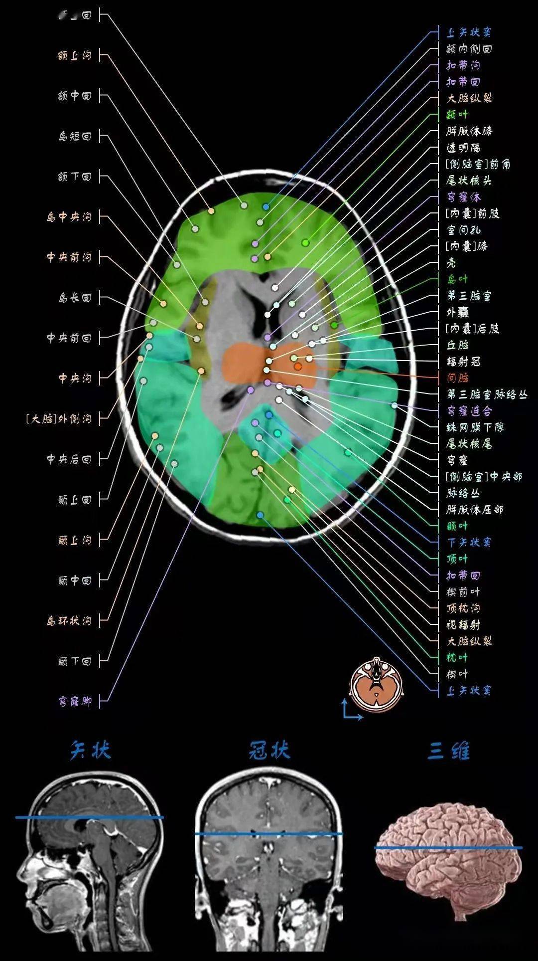 顱腦mri超詳細三維標註(最新版)_全網_影像_解剖圖