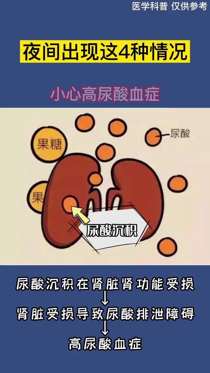 夜晚如果出现4种症状可能是高尿酸血症表现抓紧做检查肾内科杨彦芳