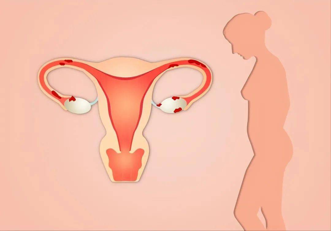 女性B型大全图卵巢图片