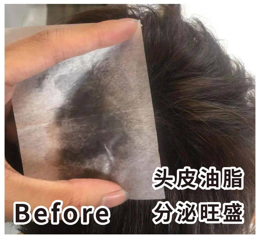 因为散着头发睡觉更健康？99%的女生都做错了，难怪头发油腻还脱发！