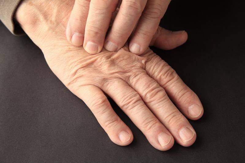 医生:手上出现3个信号,你要警惕糖尿病_皮肤_指甲_症状