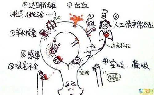 人流综合征 来自搜狐网