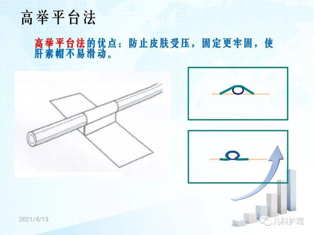 【ppt】小儿留置针规范操作及管理