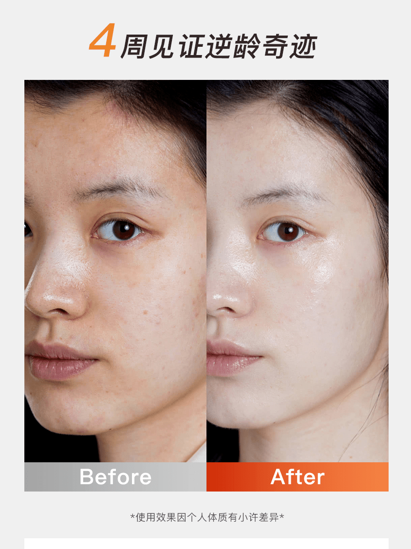 每天坚持这件事皱纹没了色斑淡了皮肤紧致光滑至少年轻20岁