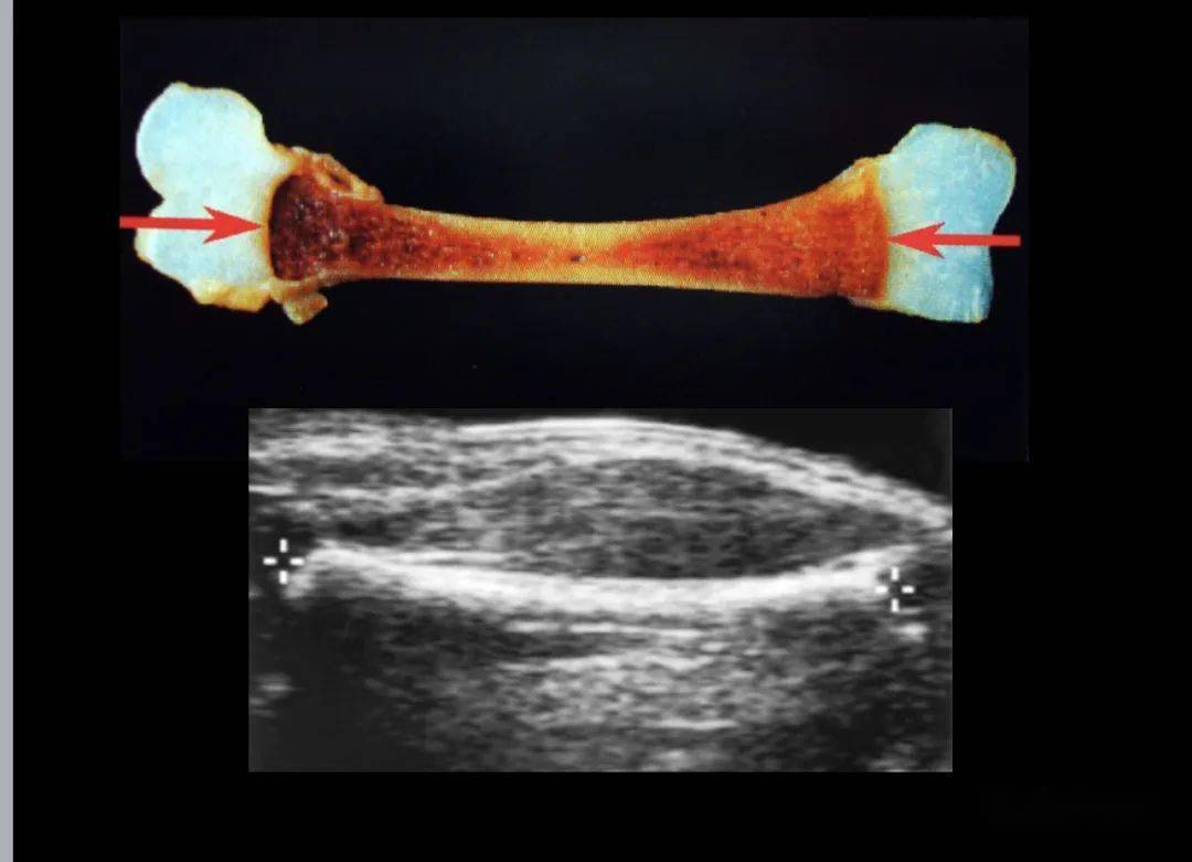 胎儿股骨是哪个部位图片