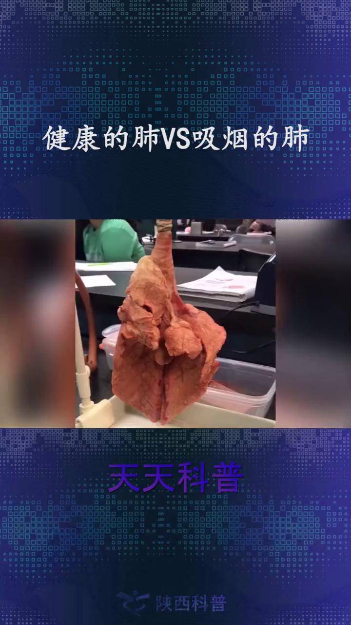 健康的肺vs吸烟的肺吸烟有害健康看了这样的肺恐怖吗肺烟健康科普