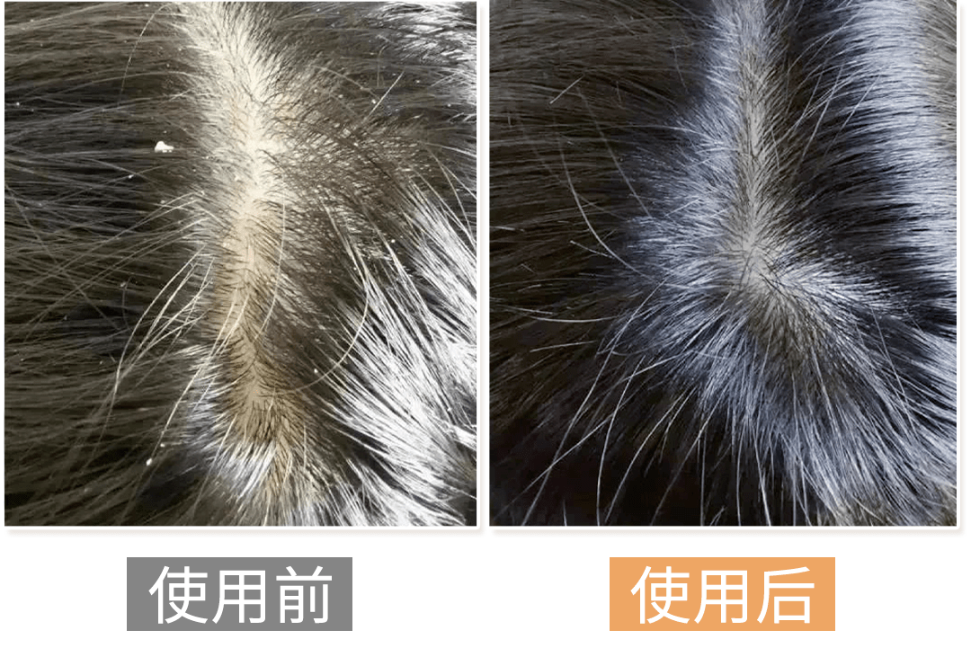 洗头头皮油脂“清道夫”!千年盐湖盐泥+北极光云杉,3天不洗头不油也不痒,头发像丝绸一样顺滑!