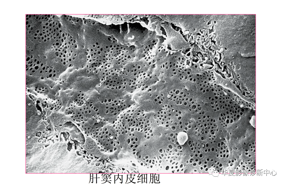 解剖|肝脏影像学与系统解剖