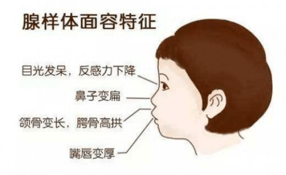 咽喉|新华全媒+|孩子睡觉老打鼾睡得香？这是病，得治！