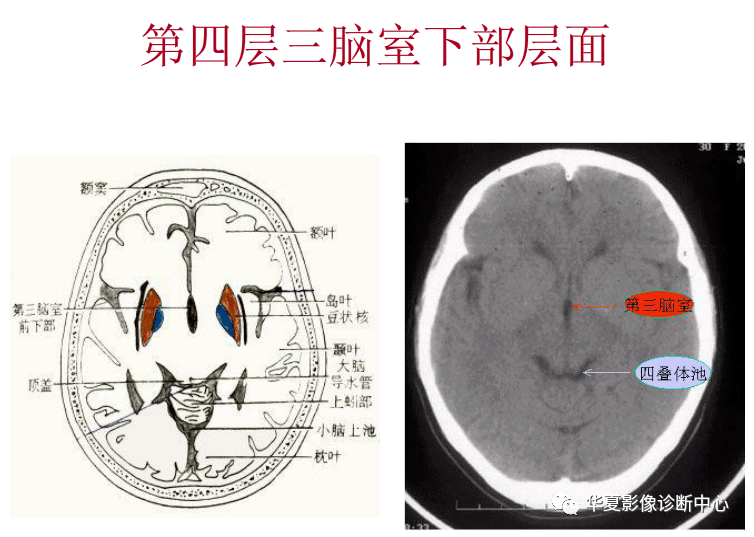 大脑|“九层颅脑”影像
