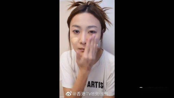 tvb甜姐兒曬素顏出事!突變醜女嚇壞網民:整容失敗?_-filter_留言_香香