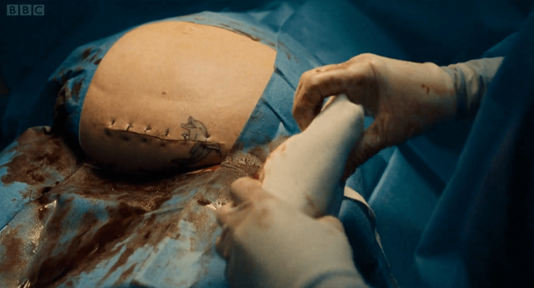 但不限于在手术台上接电话,以及在病人的纹身上缝合一道丑陋的疤痕