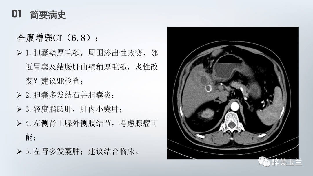 由於腦組織的能量完全依靠葡萄糖有氧氧化提供,術中血糖控制過於嚴格