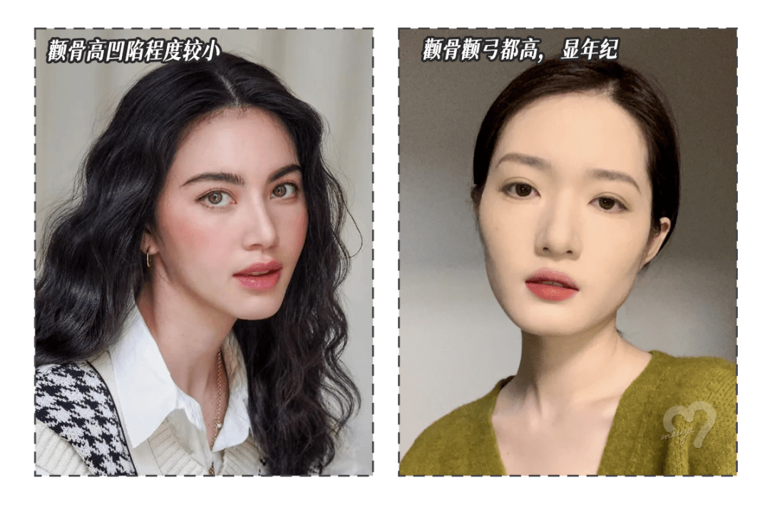 颧骨你明明才20出头，为什么就这么显老？