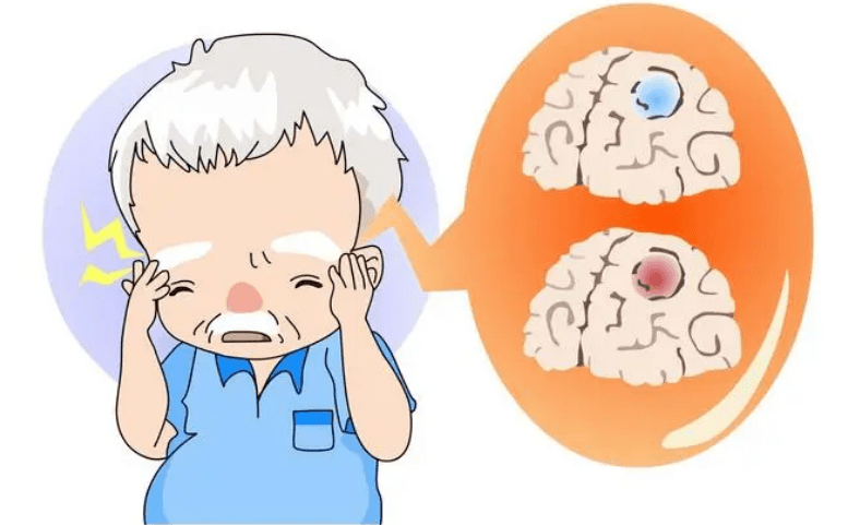 中医科普急性脑血管病的原因有哪些