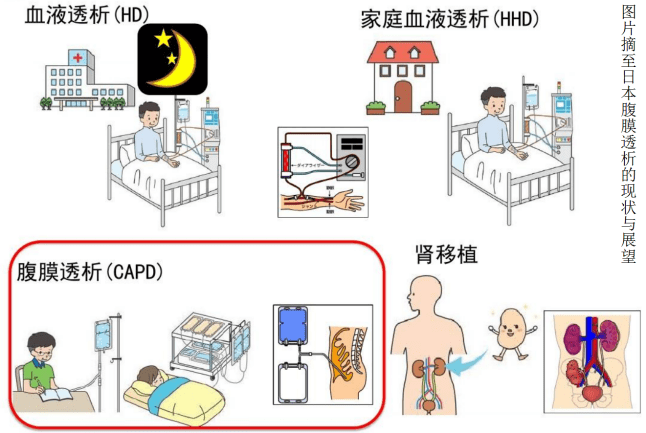 自動化腹膜透析等媽媽畢業了你就能如願返回校園