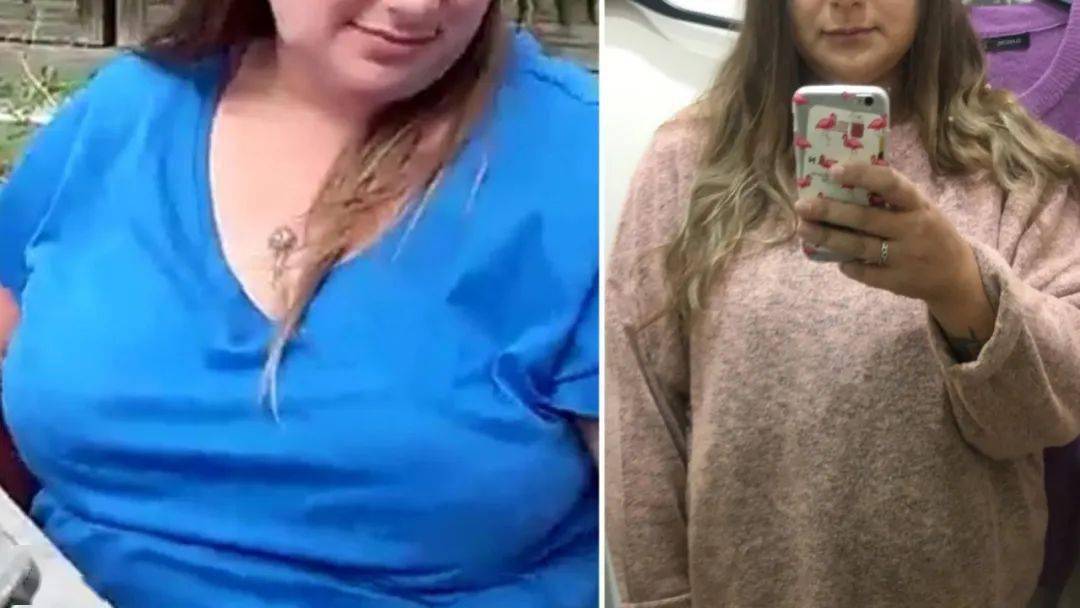 她在去年10月卖了房子,多了一些闲钱之后,就去私人医院做了缩胸手术