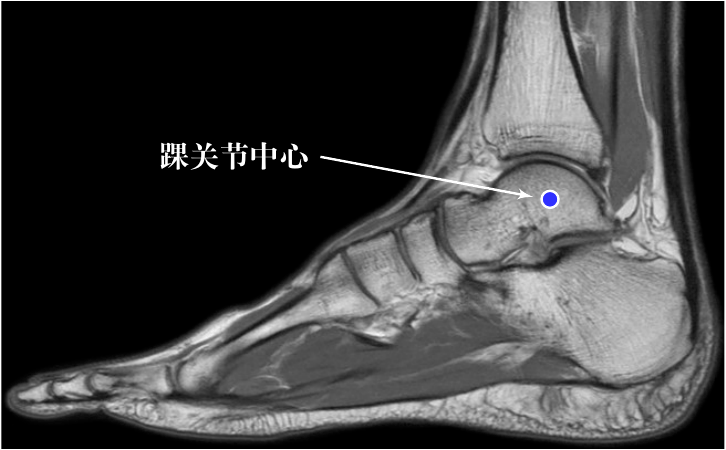 當人體的腳在做足底屈或足背屈時,腳基本上是在繞踝關節中心旋轉(圖 7