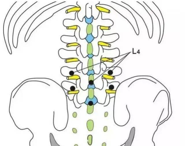 針刀治療腰椎滑脫症_關節_韌帶_解剖