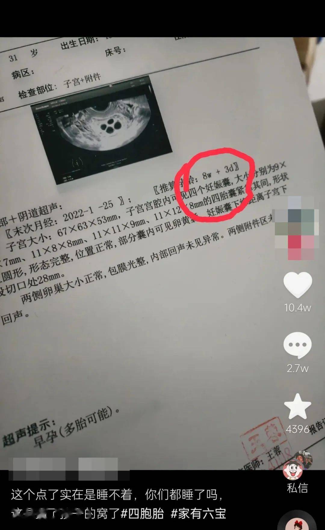 讲个笑话这样他就爱你了