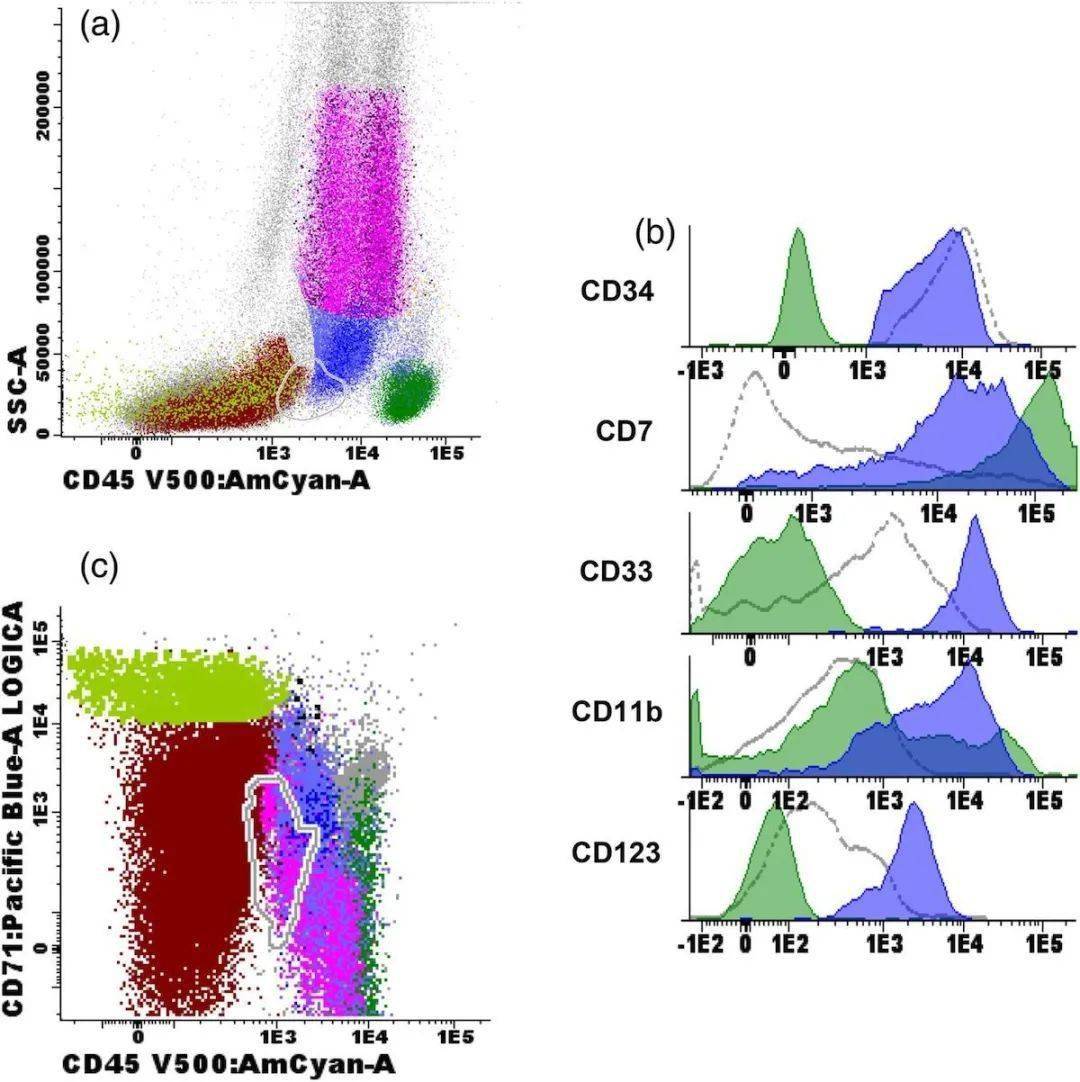mds流式诊断案例3:形态学无异常,但流式确诊的mds_血细胞_表型_of