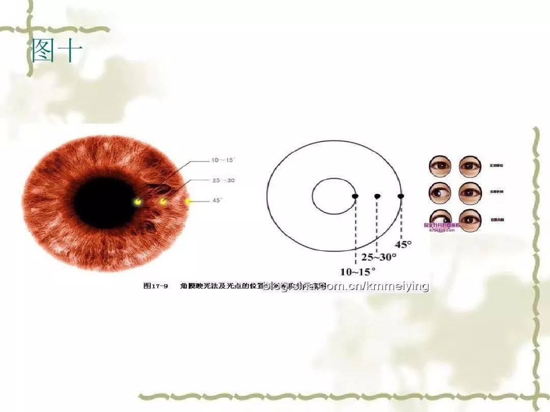 眼位检查之遮盖试验角膜映光法