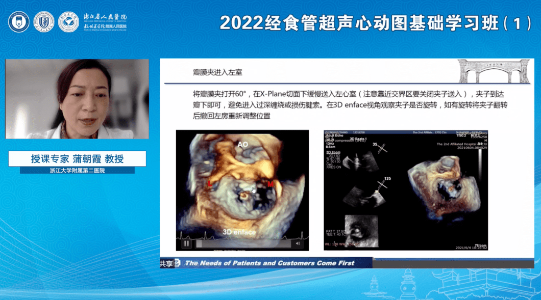 浙江省人民医院超声科成功举办2022经食管超声心动图基础学习班