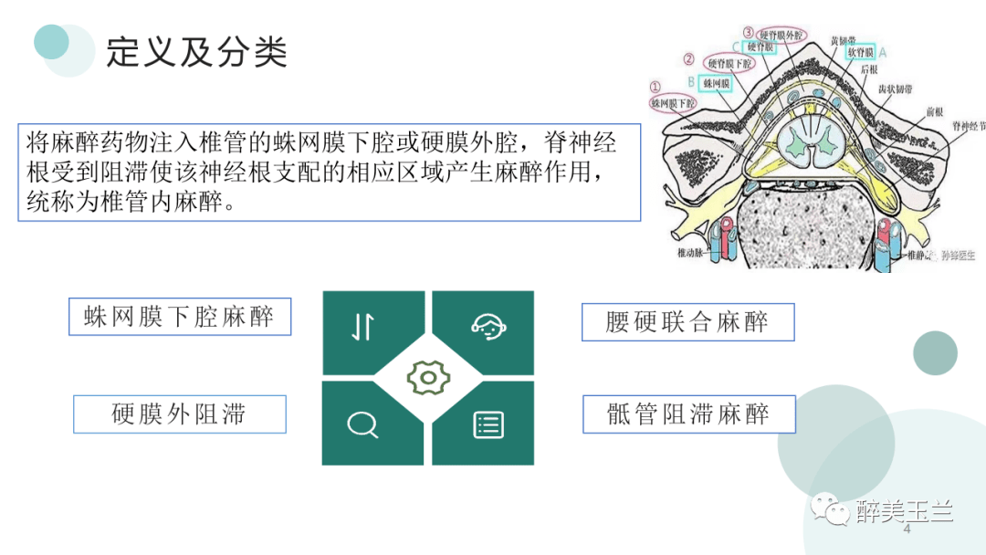 椎管内麻醉平面图片