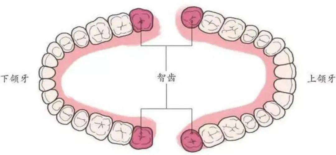 上第三磨牙图片