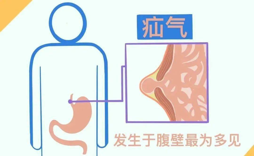 勿以疝小而不为 