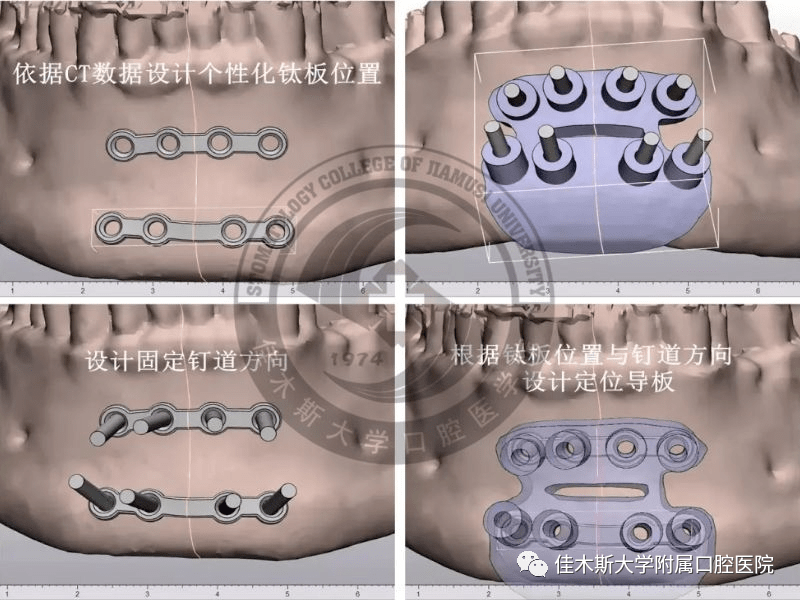 头雁领航再腾飞实现诊疗新突破佳木斯大学附属口腔医院