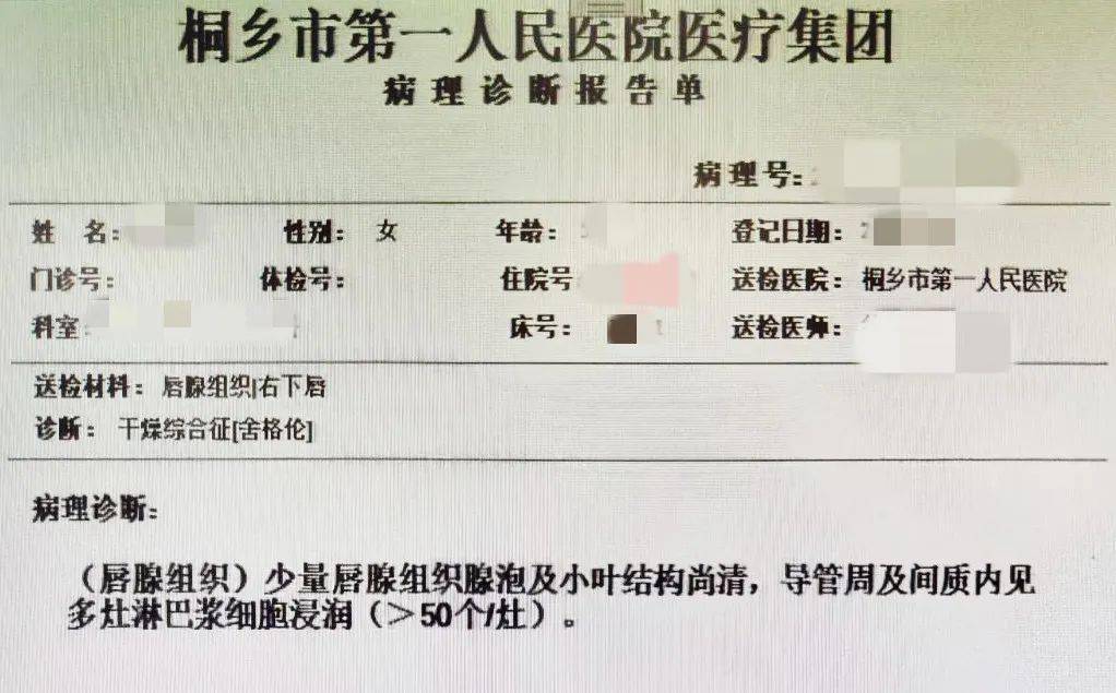 牙齿松动脱落,为进一步明确诊断,任传永医生建议患者做唇腺组织活检