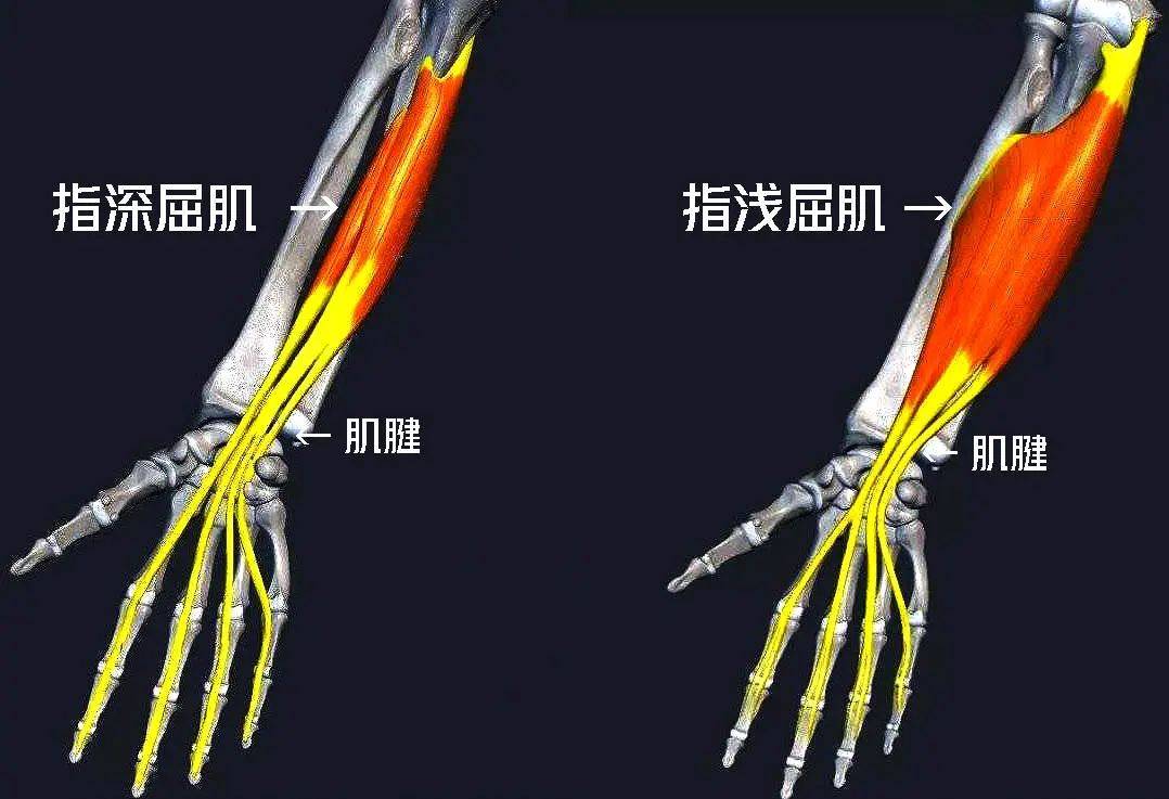 手指屈肌腱分区图片图片