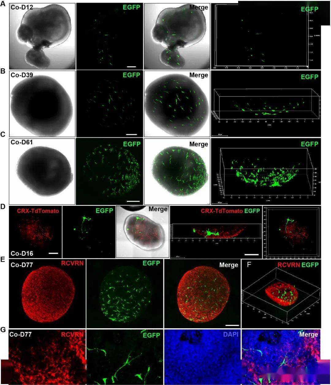 干细胞高效分化视网膜小胶质细胞