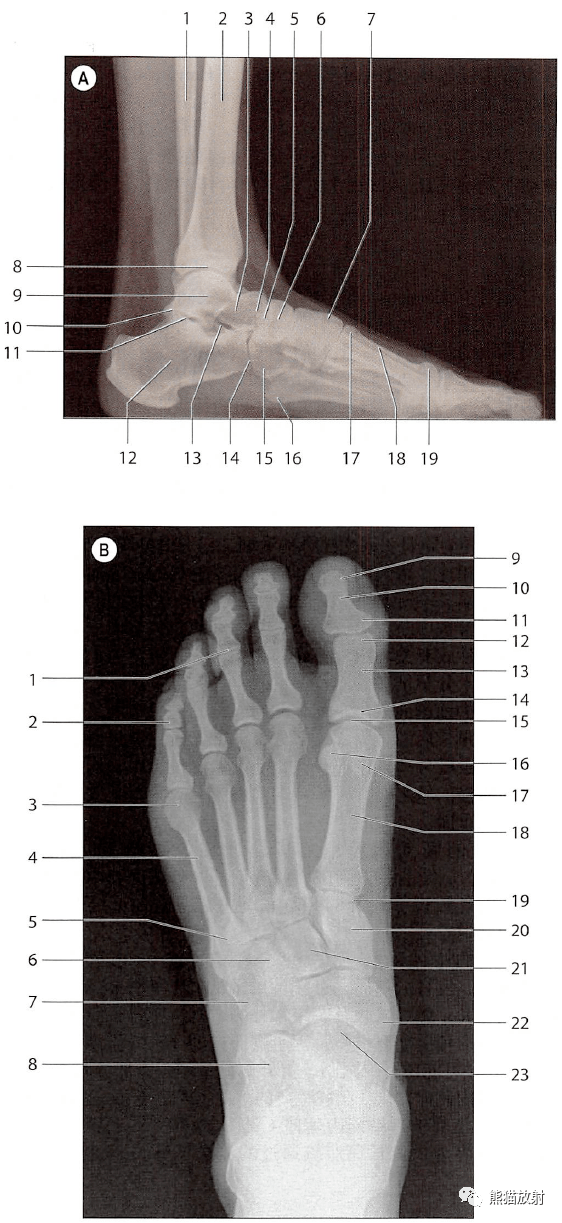 足骨x线解剖图图片