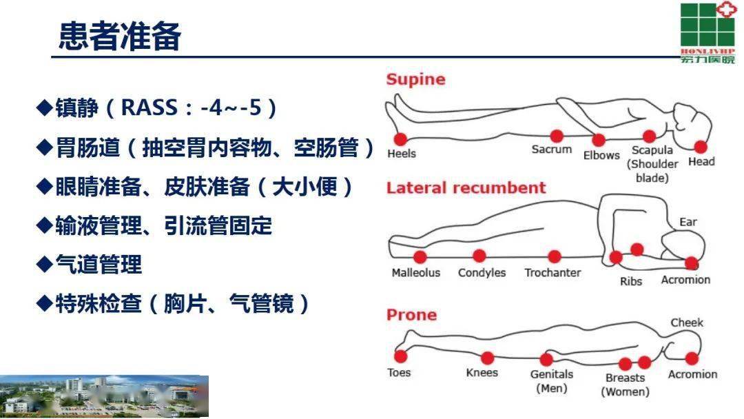 俯卧位通气原理图片图片