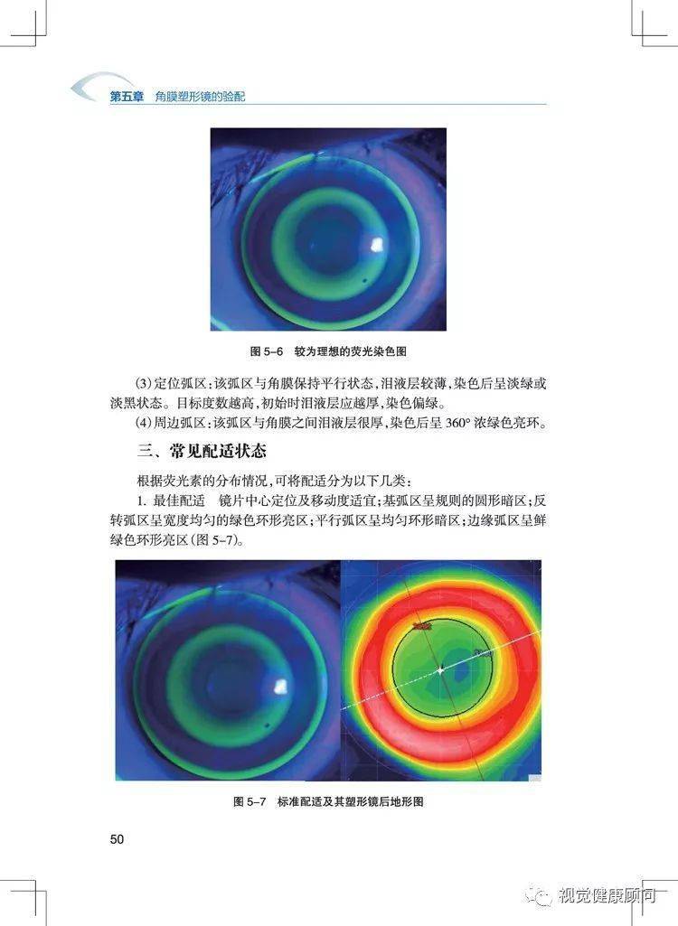 魏瑞华角膜塑形镜验配实用教程