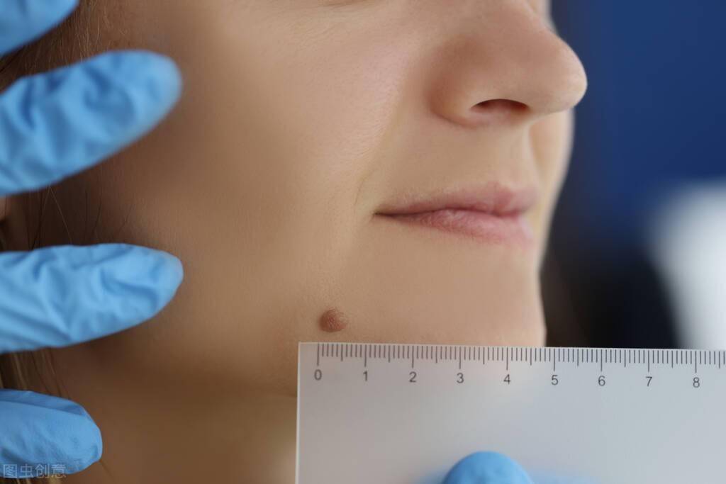 温馨提示经过以上了解,无法通过宫砂痣检验女性贞洁,这是一种封建迷信