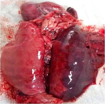 剖检知识1常见肺部疾病的解剖分析