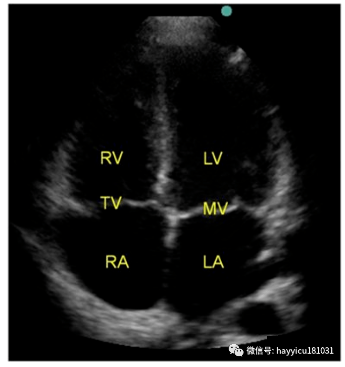重症超声心尖四腔心切面