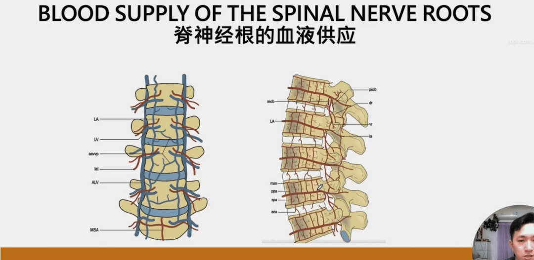 腰椎椎管狭窄如何进行物理治疗?